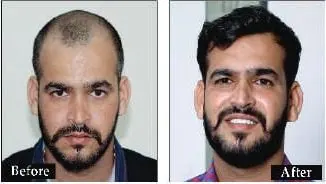 DELHI - 011-41406606 / +91-8527220878