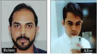 DELHI - 011-41406606 / +91-8527220878