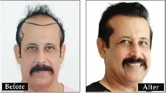 DELHI - 011-41406606 / +91-8527220878