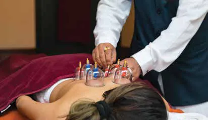 A therapist placing glass cupping cups on the back of a woman lying face down